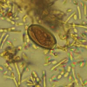 Case318_B.jpg Figure B