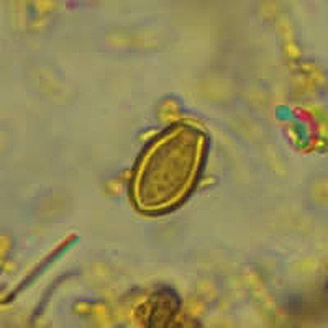 Case318_D.jpg Figure D