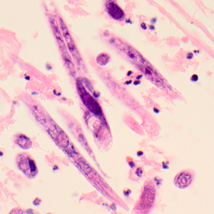 Case319_B.jpg Figure B