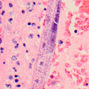 Case319_D.jpg Figure D