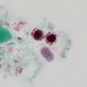 Case320_B.jpg Figure B