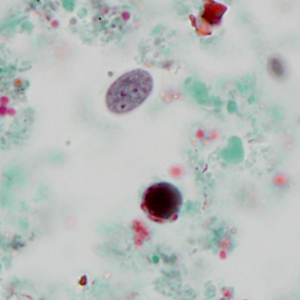 Case320_C.jpg Figure C