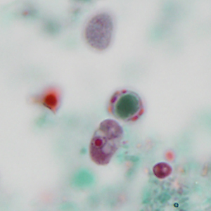 Case320_D.jpg Figure D