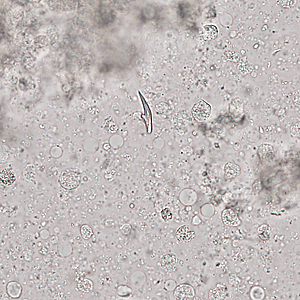 Case321_B.jpg Figure B