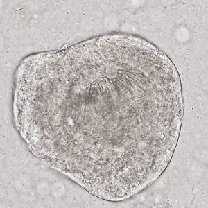 Case321_C.jpg Figure C