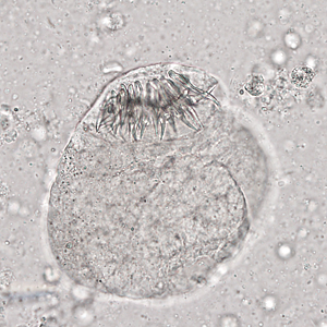 Case321_D.jpg Figure D