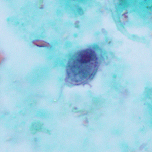 Case322_B.jpg Figure B