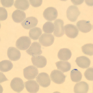 Case323_B.jpg Figure B