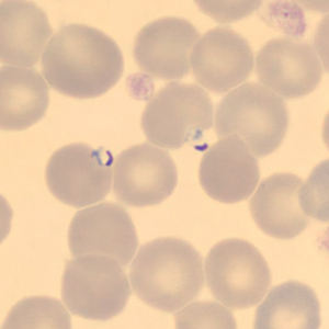 Case323_C.jpg Figure C