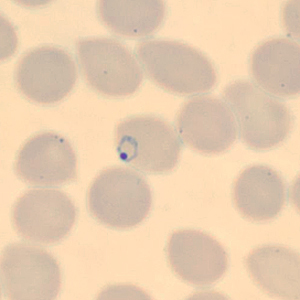 Case323_D.jpg Figure D