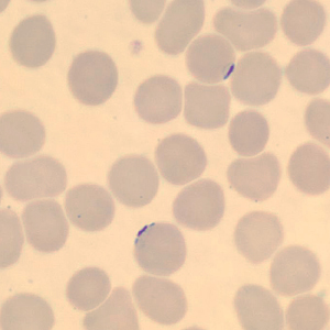 Case323_E.jpg Figure E