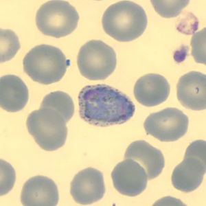 Case323_F.jpg Figure F