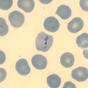 Case323_G.jpg Figure G