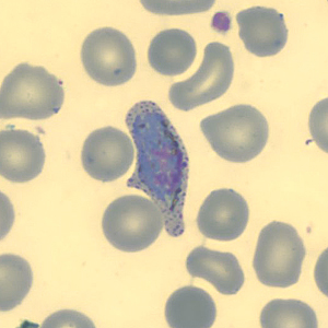 Case323_H.jpg Figure H