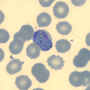 Case323_I.jpg Figure I