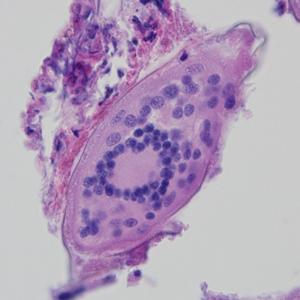 Case324_B.jpg Figure B