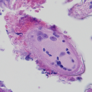 Case324_C.jpg Figure C