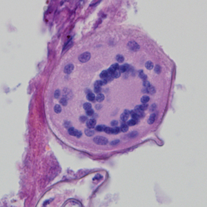 Case324_D.jpg Figure D