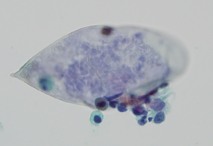 Case324_E.jpg Figure E