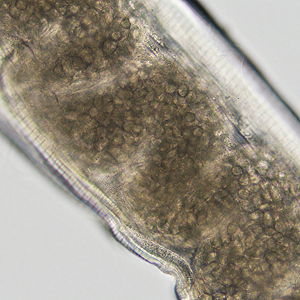 Case325_D.jpg Figure D