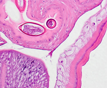 Case326_C.jpg Figure C