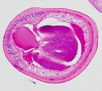 Case326_D.jpg Figure D