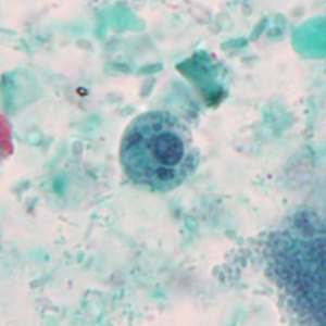 A three-year-old boy with no known international travel history was taken to his pediatrician with diarrhea and abdominal cramping. The patient was one of several children in his day care presenting with diarrhea.