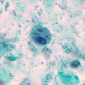 Case327_B.jpg Figure B