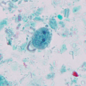 Case327_C.jpg Figure C