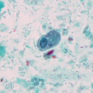 Case327_D.jpg Figure D