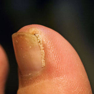 Case328_B.jpg Figure B