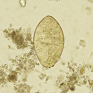Case329_C.jpg Figure C