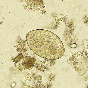 Case329_D.jpg Figure D