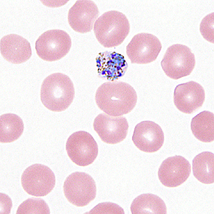 Case330_B.jpg Figure B