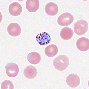 Case330_C.jpg Figure C