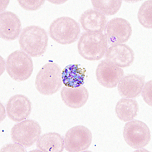 Case330_D.jpg Figure D