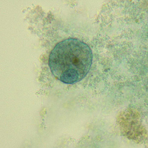 Case331_B.jpg Figure B