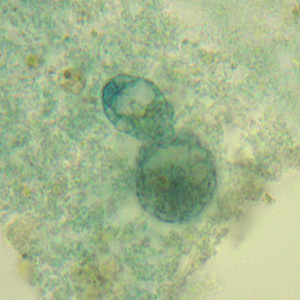 Case331_C.jpg Figure C