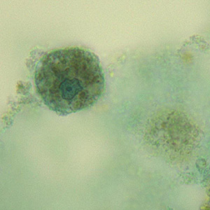 Case331_D.jpg Figure D