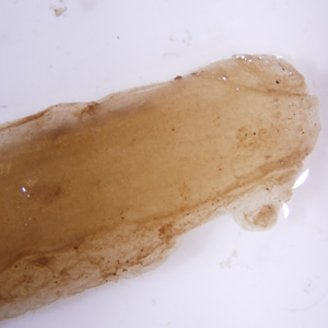 Case332_B.jpg Figure B