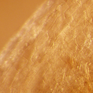 Case332_C.jpg Figure C