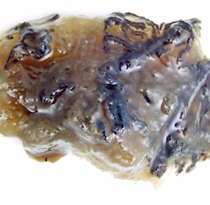 Case332_D.jpg Figure D