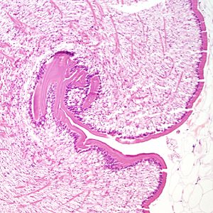 Case333_B.jpg Figure B