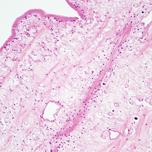 Case333_C.jpg Figure C