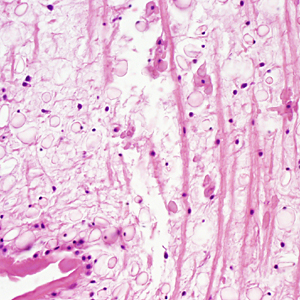 Case333_D.jpg Figure D