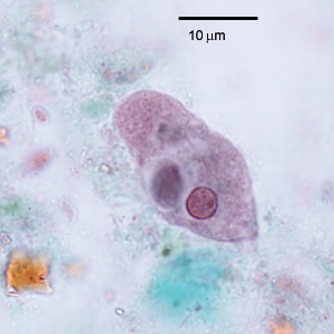 October - 2012 - Case #334 During the laboratory component of the DPDx Diagnostic Parasitology Workshop on Intestinal Parasites, a participant made an observation on a trichrome-stained fecal smear and wanted to share with the class.