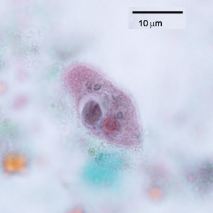 Case334_B.jpg Figure B
