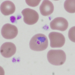 Case335_D.jpg Figure D