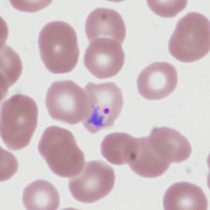 Case335_E.jpg Figure E