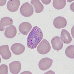 Case335_F.jpg Figure F